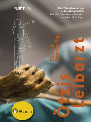 cover image of Ötzis Leibarzt